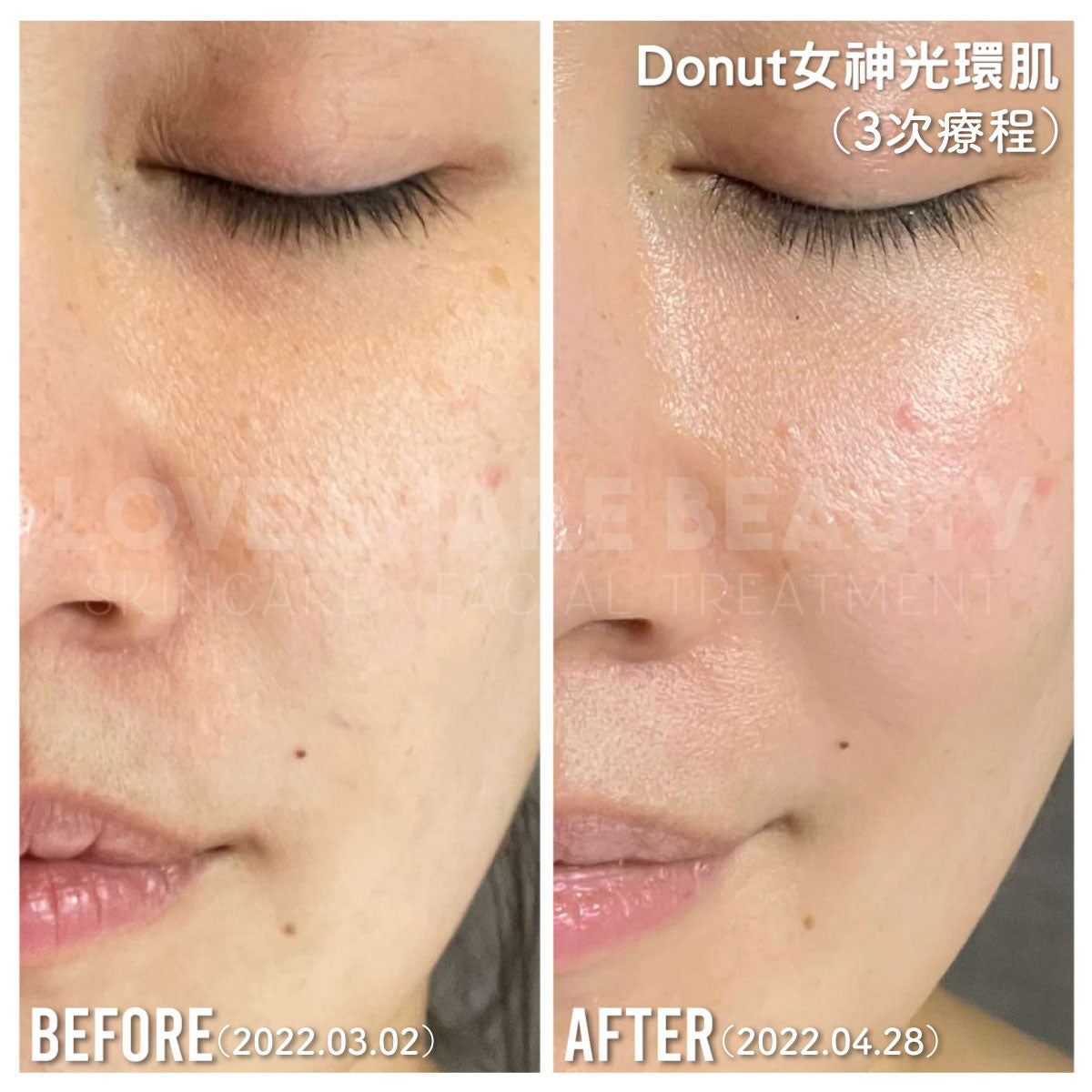 Donut 女神光環肌(單次)
