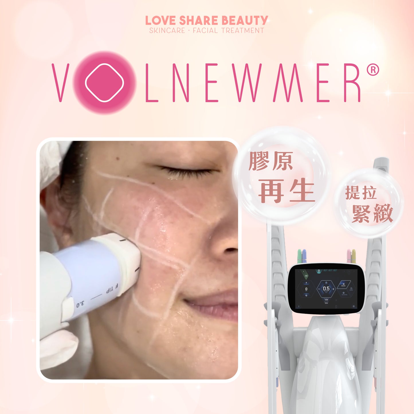 Volnewmer黃金椿(單次)